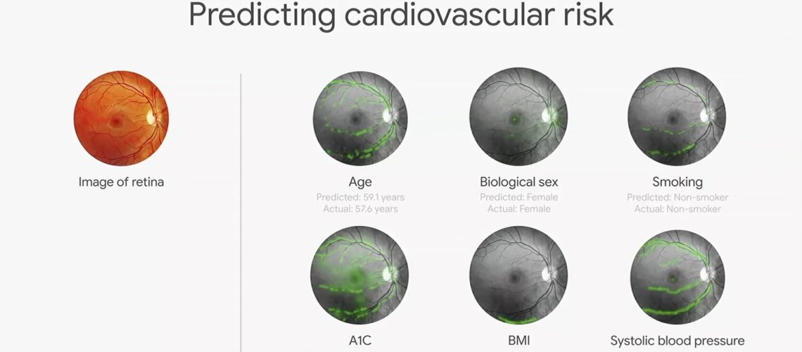 Predicting cardiovascular risk